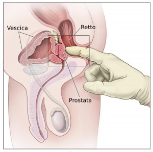 prostatan